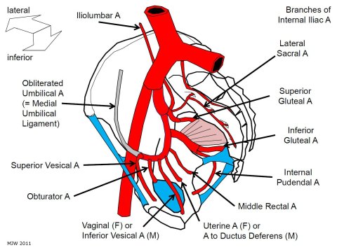 Internal Iliac Arteries - MJW 2011